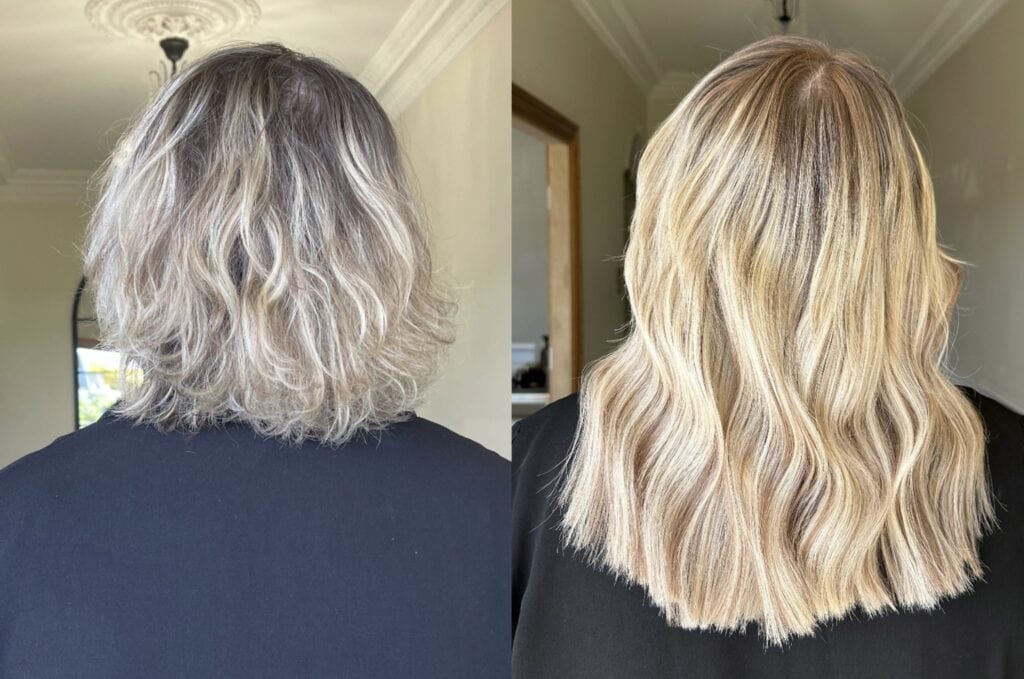 chemotherapy, cancer, hair loss, hair loss during cancer, chemo hair loss, hair loss from chemo, radiotherapy, hair growth, hair loss solutions, fast hair growth, chemo side effects, hair loss from cancer, cancer side effects, hair extensions for chemo, hair extensions for cancer, wig for hair loss, wig for cancer, australian hair loss